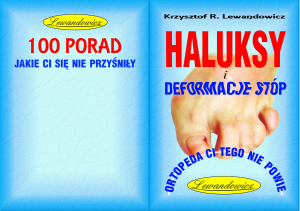 HALLUKSY, DEFORMACJE STÓP - 50STR. MINI PORADNIK